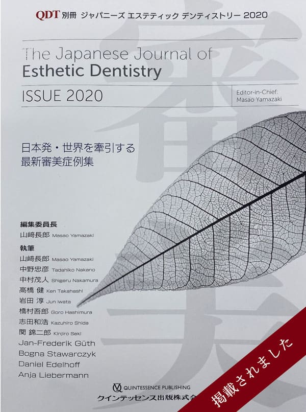 QDT別冊 The Japanese Journal of Esthetic Dentistry