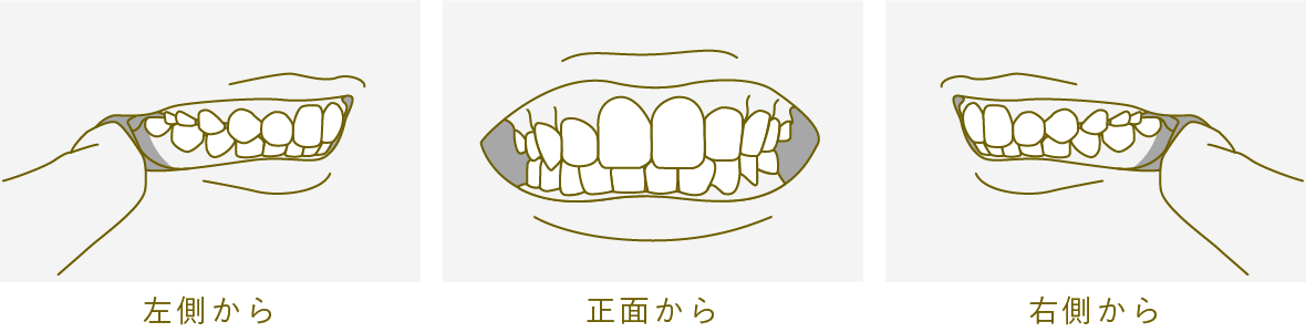 スマホで歯並びを撮影する際のポイント